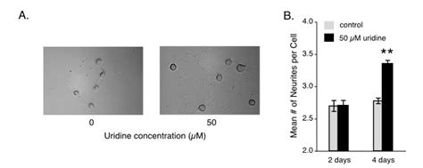 Supplements for Improving Neurite Growth and Membrane Integrity – Opti ...