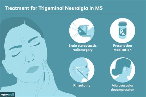 Een overzicht van trigeminusneuralgie bij MS - Med NL