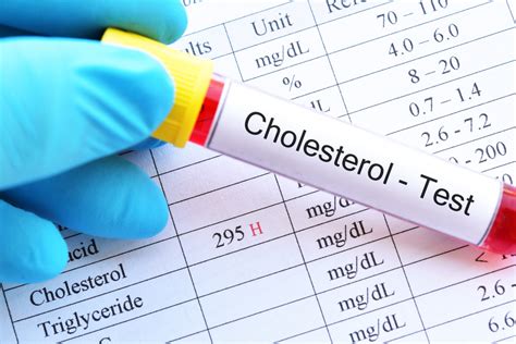 How To Check For Cholesterol - Impactbelief10