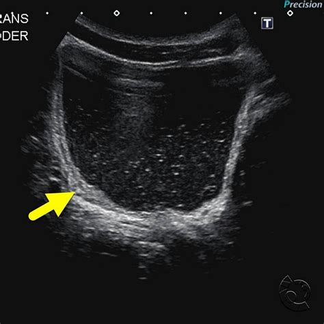 Pin on abdomen-pelvis