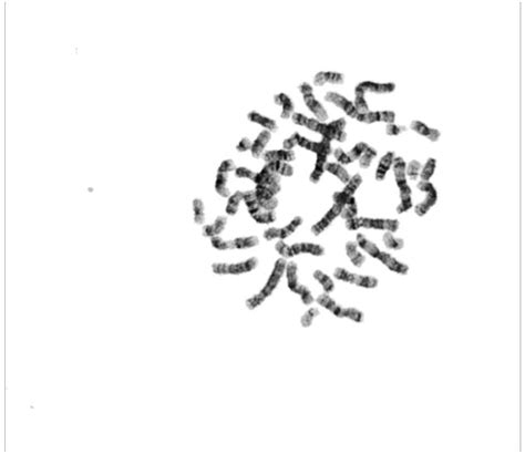 Image showing metaphase, processed metaphase and Karyotype 2