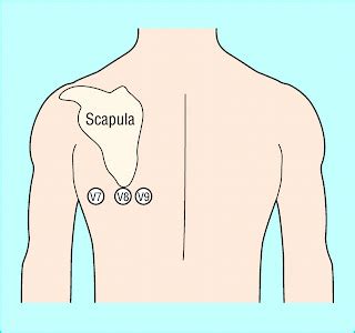 Anterior ischemia or posterior STEMI? | Paramedicine 101