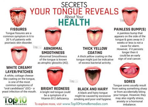 13 Things Your Tongue Can Indicate About Your Health | Tongue health, Health tips, Health remedies