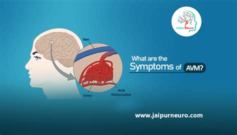 What are the symptoms of AVM? | JaipurNeuro Clinic