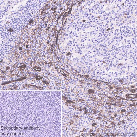 Recombinant Anti-Caveolin-1 antibody [E249] - BSA and Azide free KO Tested (ab230262)