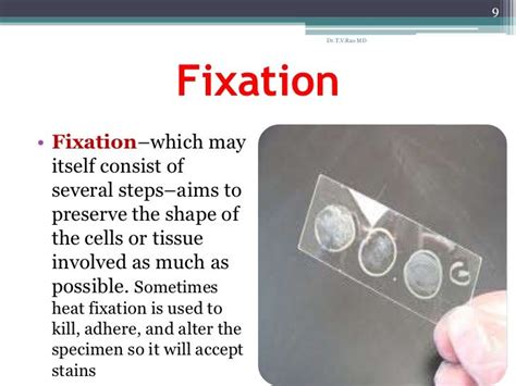 why heat fix bacterial smears - Google Search | Laboratory science ...