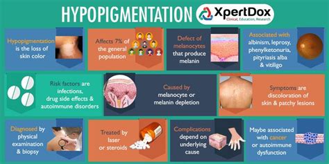 Hypopigmentation | Vitiligo, Health, Skin color