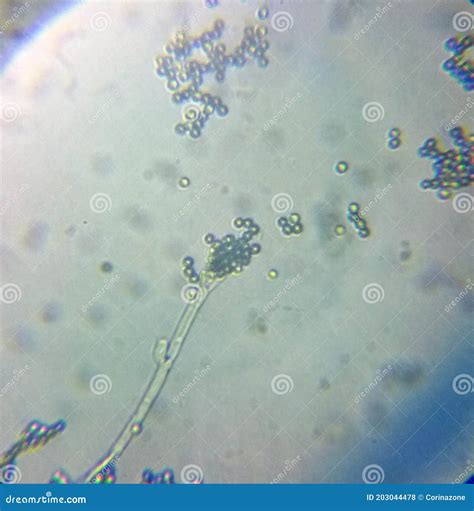 Penicillium Fungi Microscope