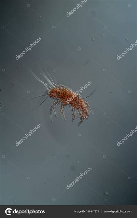 House Dust Mites Microscope 100X — Stock Photo © PantherMediaSeller ...