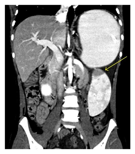 CT scan with oral and intravenous contrast. CT scanogram (a), axial CT ...