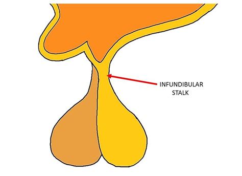 Infundibular stalk - definition — Neuroscientifically Challenged