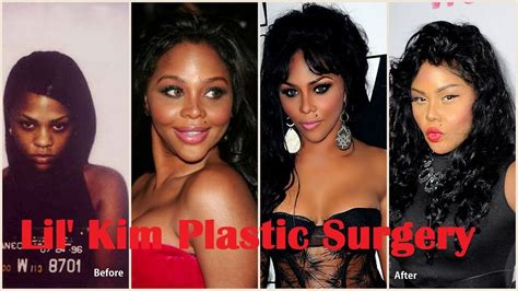 Lil Kim Before and After Plastic Surgery - YouTube