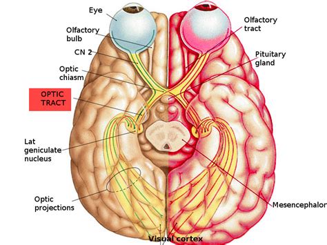 [Figure, Optic tract pathway Image courtesy S Bhimji MD] - StatPearls - NCBI Bookshelf