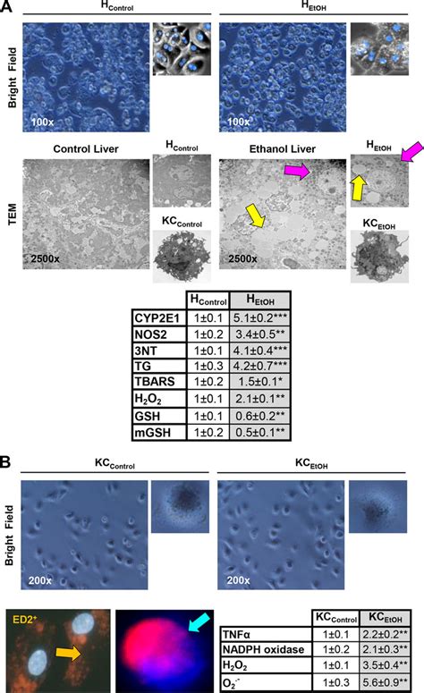 Primary hepatocytes and Kupffer cells from control and ethanol-fed mice ...