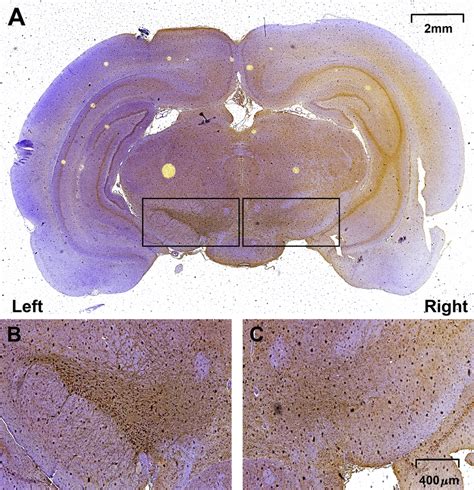 Loss of TH⁺ neurons in medial forebrain bundle (mfb) after the ...