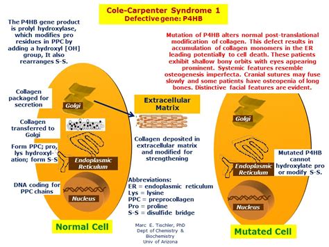 Cole-Carpenter Syndrome 1 | Hereditary Ocular Diseases