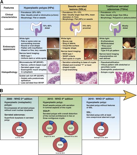 Terminology, Molecular Features, Epidemiology, and Management of Serrated Colorectal Neoplasia ...