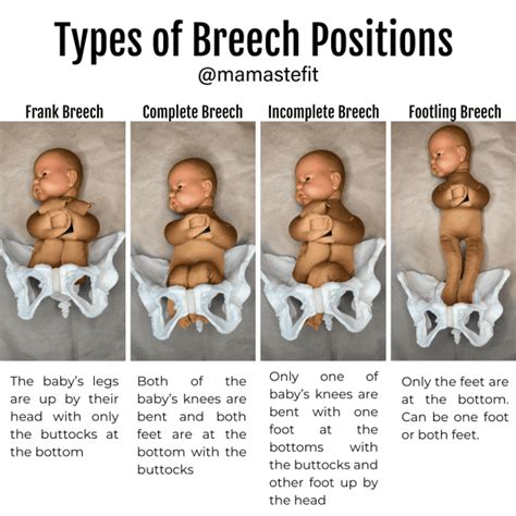 Breech Positions and Birth Options - MamasteFit