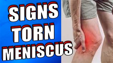 What are the Causes & Symptoms of a Torn Meniscus? - YouTube