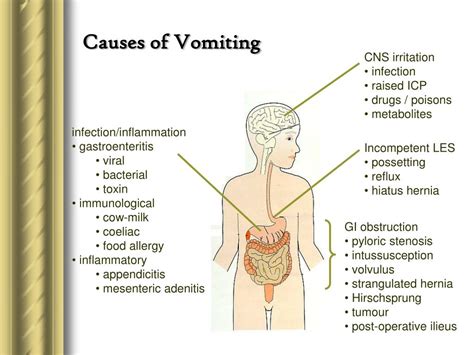 PPT - Vomiting, Diarrhoea, Abdominal Pain & Fluid Therapy PowerPoint Presentation - ID:6518300