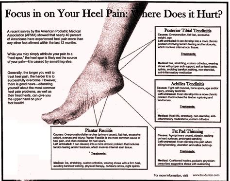 Calcaneal spur Heel pain Homeopathic Treatment