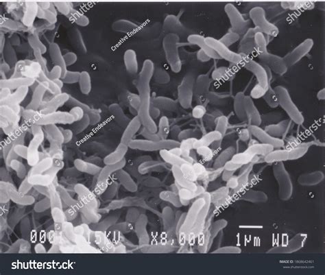 3,148件の「Bacteria electron microscope」の画像、写真素材、ベクター画像 | Shutterstock