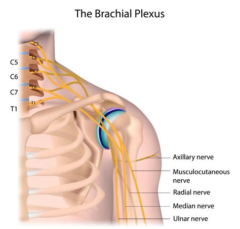 Brachial Plexus Injury | Living With Paralysis | Reeve Foundation