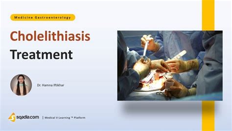 Cholelithiasis Treatment | Medicine Gastroenterology - sqadia.com