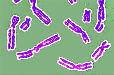 How DNA Repair Can Go Wrong and Lead to Disease | Tufts Now