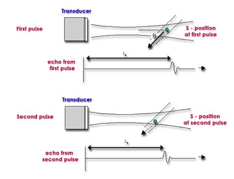 Doppler Physics: DOPPLER ULTRASOUND : PRINCIPLES & PRACTICE