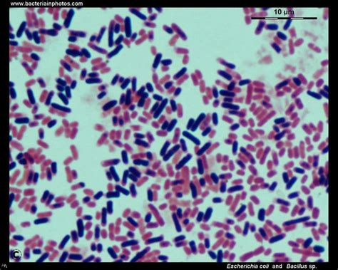 Micrococcus Luteus Capsule Stain Results - Duane Pickrell Kapsels