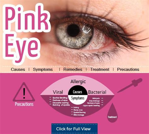 Signs And Symptoms Of Pink Eye Vs Allergies