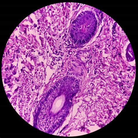 420+ Thyroid Gland Histology Pictures Stock Photos, Pictures & Royalty ...