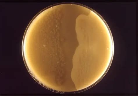 Clostridium - What is it? Morphology, Classification, Characteristics