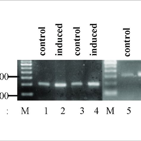 Immunohistochemical staining of the cytospin preparation of nRBC with... | Download Scientific ...