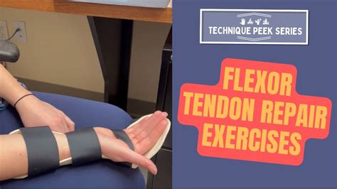 Flexor Tendon Repair: A Comparison of Two Protocols