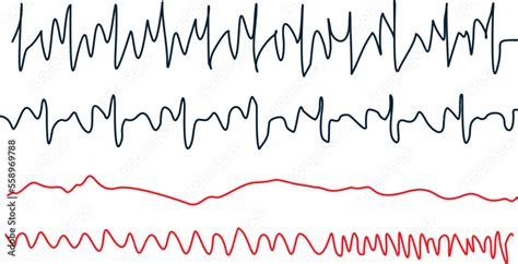 Ekg heart rate monitor. Healthcare concept using technology. Stock ...