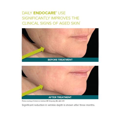 Daily Endocare use significantly improves the clinical signs of aged ...