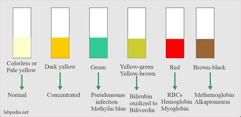 Normal Makeup Of Urine | Saubhaya Makeup