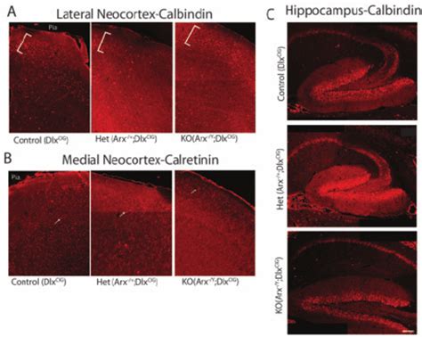 Representative Calbindin and Calretinin immunohistochemistry in the ...