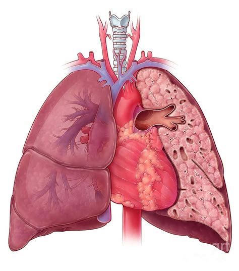 Heart And Lung Anatomy, Illustration by Evan Oto | Lung anatomy, Human anatomy art, Heart and lungs