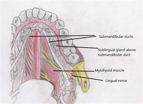 Excision of Sublingual Gland | Pocket Dentistry