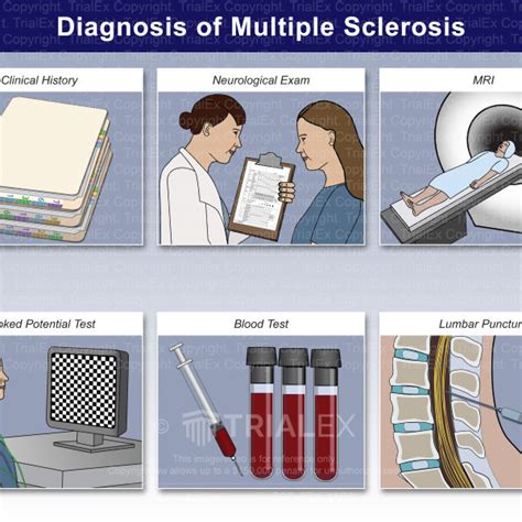 Diagnosis of Multiple Sclerosis - TrialQuest Inc.