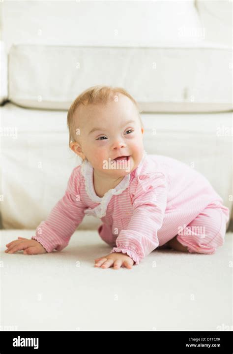 Caucasian baby girl with Down Syndrome Stock Photo - Alamy