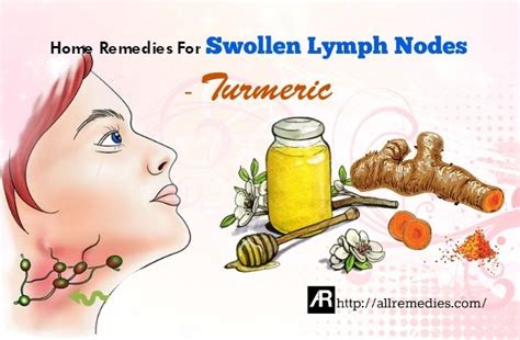 How To Treat Swollen Lymph Nodes In Neck Naturally 12 Ways | Images and Photos finder