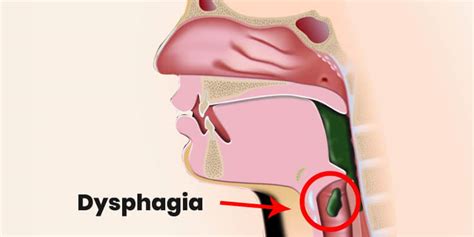 What is Pharynx? 25 Amazing Facts about Pharynx Parts, Function & Anatomy