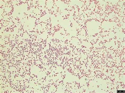 Morphology of Pseudomonas arenae sp. nov. strain VK110 depicted ...