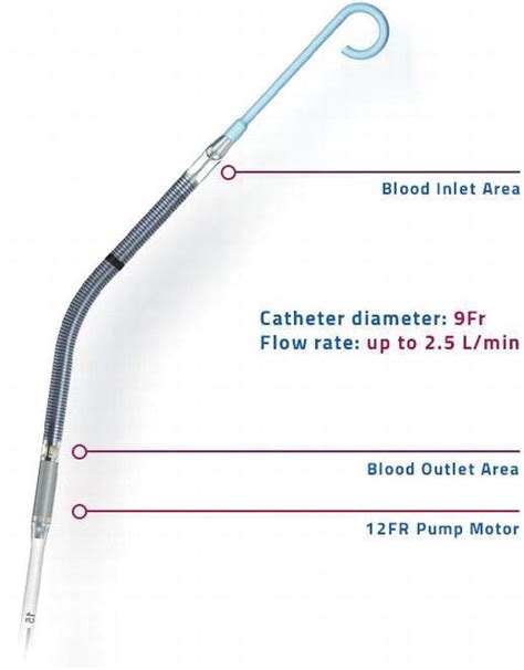 Peripheral Ventricular Assist Devices in Interventional Cardiology: The Impella® Micro-Axial ...