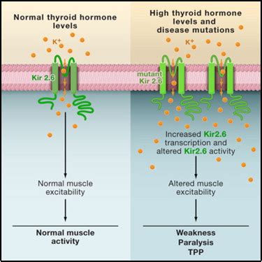 Hypokalemic periodic paralysis; Familial Hypokalemic Periodic Paralysis ...