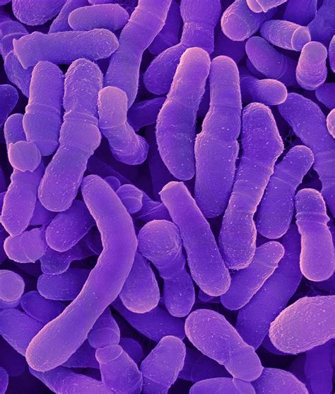 Corynebacterium Tuberculostearicum Photograph by Dennis Kunkel ...